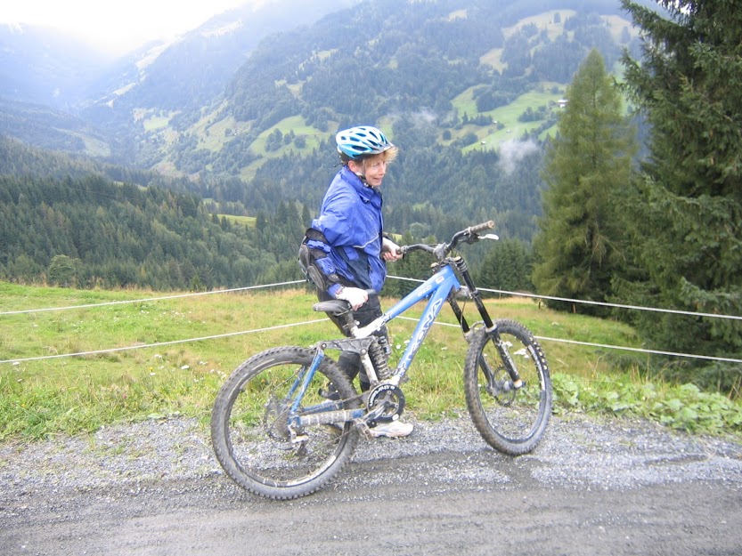 Yes of course it hurts